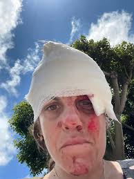 Nic has been a part of our Costa Mesa community his entire life — a proud  Estancia High School alum and a friend to so many. He's sweet, genuine, and  the kind