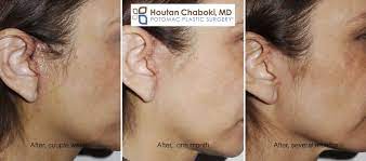 We did not find results for: Heal Faster After Plastic Surgery