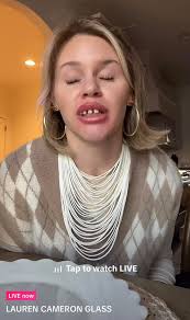Why does Lauren Cameron Glass wear fake teeth she got from a Halloween  store? : r/tiktokgossip