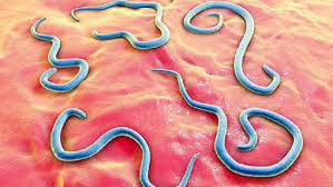 Antara beberapa sifat buruk babi, binatang paling rakus, kotor, dan hina di kelasnya. Sumbatan Usus Anak Oleh 1 2 Kg Cacing Gelang Info Sehat Klikdokter Com