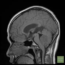 Pin On Excalibur Healthcare S Imaging Teleradiology Pins
