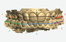 Image result for ochrana chrupu