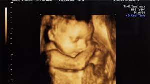 Meski belum terlalu lancar, tapi bayi sedang belajar melambaikan tangannya sebagai tanda perpisahan di masa perkembangan si kecil umur 9 bulan. Alasan Di Balik Janin Lebih Sering Gerak Di Trimester Tiga