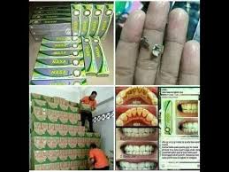 Wa 083838404063 Cara Merontokkan Karang Gigi Menggunakan Pasta Gigi Nasa Pgn Youtube