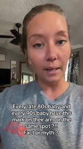 Indigo Child Birthmark: Fact or Myth Explained