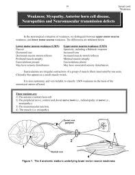 Weakness Myopathy Anterior Horn Cell Disease Neuropathies And