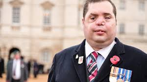 Blind Morley veteran to share rehab tips with US