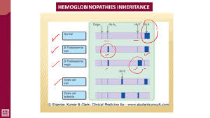 Hematology 2 U1 L37 Hemoglobin Electrophoresis
