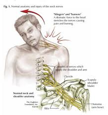 Stretching can help to release the rhomboids and alleviate the discomfort keep your hands and feet in place as you extend your hips back, which will allow your shoulders to be pulled forward. Brachial Plexus Traumatic Nerve Injuries Hughston Clinic