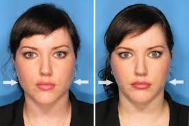 Pin by Blue Medical Spa