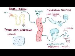 Image result for Hypermagnesemia