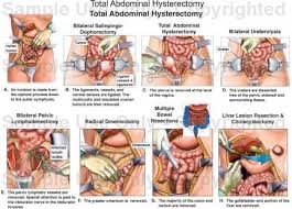 Cervical cancer happens when the cells of your cervix change. Benyapa Namsudta Benyapanamsudta Profile Pinterest