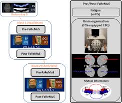 Check spelling or type a new query. Cortical Neurodynamics Changes Mediate The Efficacy Of A Personalized Neuromodulation Against Multiple Sclerosis Fatigue Scientific Reports