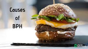 Is Your Prostate Causing You Problems Natural Bph Treatment Planet Naturopath