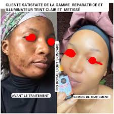 Iris Light Skin and body Care