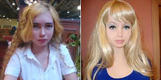 8 Extreme Plastic Surgery Transformations Extreme Plastic Surgery Celebrity Plastic Surgery Plastic Surgery