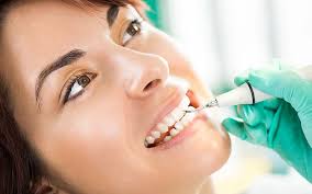 Dental Cleaning, Why Bother?