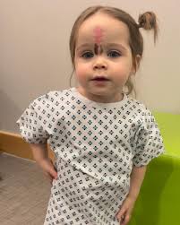 Parents Sent Daughter to Surgery to Remove Rare Birthmark, “People Would  Stare at Her”