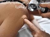 مدونة صور
