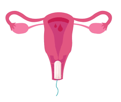 Pierre dormait, quand soudain le télephone a sonné. Tampon Hygienique Le Mettre Le Retirer Que Faire En Cas D Oubli