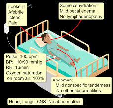 Image result for G6PD Deficiency Detection