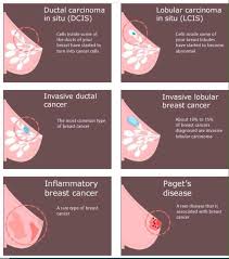 These tubes, which are hollow, allow lymph fluid to drain out of the breast. Mammo