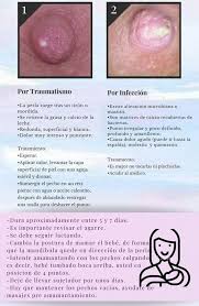 Amar Hablar Y Criar Perla De Leche Son Los Llamados Puntos Blancos Conductos Obturados Que Pueden Ser De Origen Traumatico Tiron O Mordid O Por Infeccion Por Trauma Hay Una Causa Efecto
