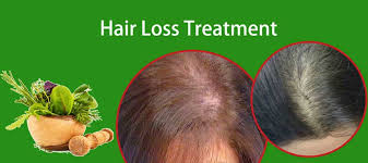 Try some of these pastes. How Effective Is Ayurveda To Treat Hair Loss And In Hair Regrowth Sanjivani Ayurvedashram
