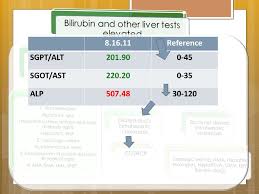 Did you ask yourself is sgot and sgpt blood test necessary for me?. Laboratory Work Up Reference Direct Bilirubin Indirect Bilirubin Total Bilirubin Sgpt Alt Sgot Ast Ppt Download