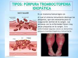 Pti dura menos de 6 meses y que se. Que Es Purpura Trombocitopenia Idiopatica Purpura Trombocitopenica Idiopatica Pti