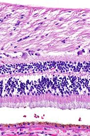 Is this the feeling i need to walk with? H E Stain Wikipedia