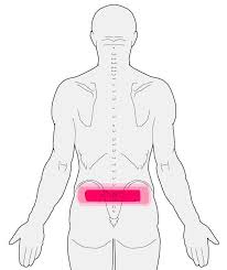 Pin On Trochanteric Bursitis