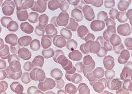 We did not find results for: Red Blood Cell Definition Functions Facts Britannica