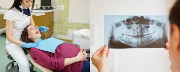 Ibu Hamil Ke Dokter Gigi Bolehkah Kapan Sebaiknya Mamaschoice Id