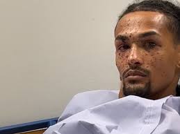 Fundraiser by Levi Uriyo : Firework Accident: Anything Helps