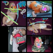 Cushing's syndrome is the collection of signs and symptoms due to prolonged exposure to glucocorticoids such as cortisol. Facebook