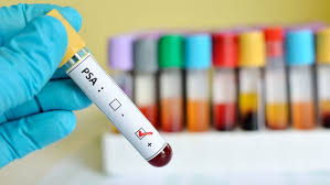 When malignant cancer cells form and grow within a person's breast tissue, breast cancer occurs. Psa Tests Aren T Great For Diagnosing Prostate Cancer Here Are Some Better Options In The Works Los Angeles Times