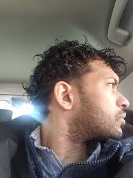 Has anyone tried finasteride or minoxidil for hair loss?