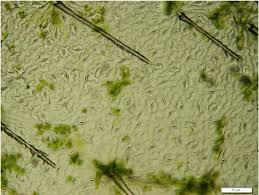 Autologous transgenic epidermal stem cell cultures are used to reconstitute almost the entire epidermis of a patient with severe junctional epidermolysis bullosa. Simple Methods For Screening And Statistical Analysis Of