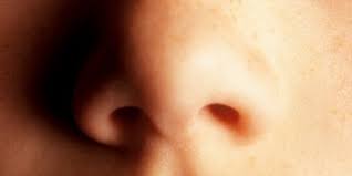 Sel yang lepas itu akan meninggalkan permukaan kulit yang 'terbuka' dan terasa perih. Atasi Kulit Kering Di Area Hidung Dalam 5 Menit Dengan Bahan Alami Merdeka Com