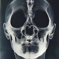 Image result for Skull XRay