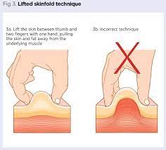 An unexpected drop in hematocrit or blood pressure should lead to a search for a bleeding site (see adverse reactions. Administering Drugs Via A Subcutaneous Injection Nursing Times