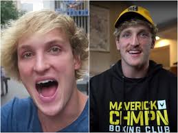 Alfie deyes 2021 altezza (altura): Then And Now What Youtubers Looked Like In Their First Video Vs Now