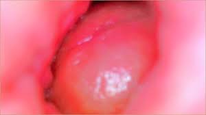 🎬 トレーラー:私のピンク色のマンコの中の内視鏡カメラは、彼が私を精液で満たす様子を記録します🎥💎 - 本物のカップル