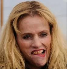 Jesse and Wendy had the same level of addiction, because Wendy has all  stained teeth while Jesse a perfect smile?