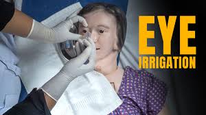 Image result for Eye Irrigation