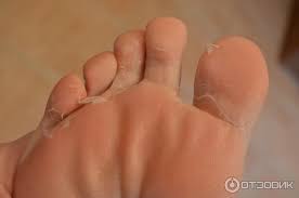 как убрать мертвую кожу с ног с помощью аспирина Otzyv O Otshelushivayushaya Maska Noski Dlya Nog Skinlite Otshelushivayushaya Maska Noski Dlya Nog Skinlite Vse Plyusy I Minusy Eto Maski Foto Eksperimenta