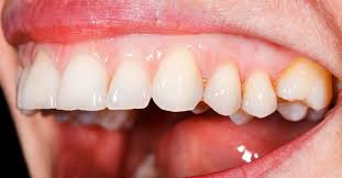 We include products we think are useful for our. Pale Gums Causes Symptoms Treatment And Warning Signs