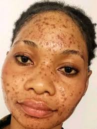 Help I am stuck in the garbage.