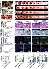 Deaths are most often associated with malformations. Intra Operative Bioprinting Of Hard Soft And Hard Soft Composite Tissues For Craniomaxillofacial Reconstruction Moncal Advanced Functional Materials Wiley Online Library